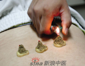 灸法的種類(lèi)  你知道多少？